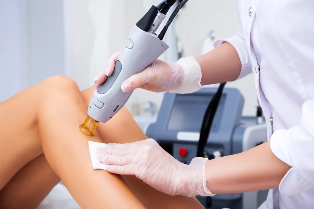 Laser-Hair-Removal in Chicago, IL, | Derma Bliss Medical Spa