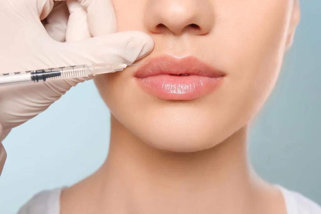 Dermal-Fillers-in Chicago, IL, | Derma Bliss Medical Spa