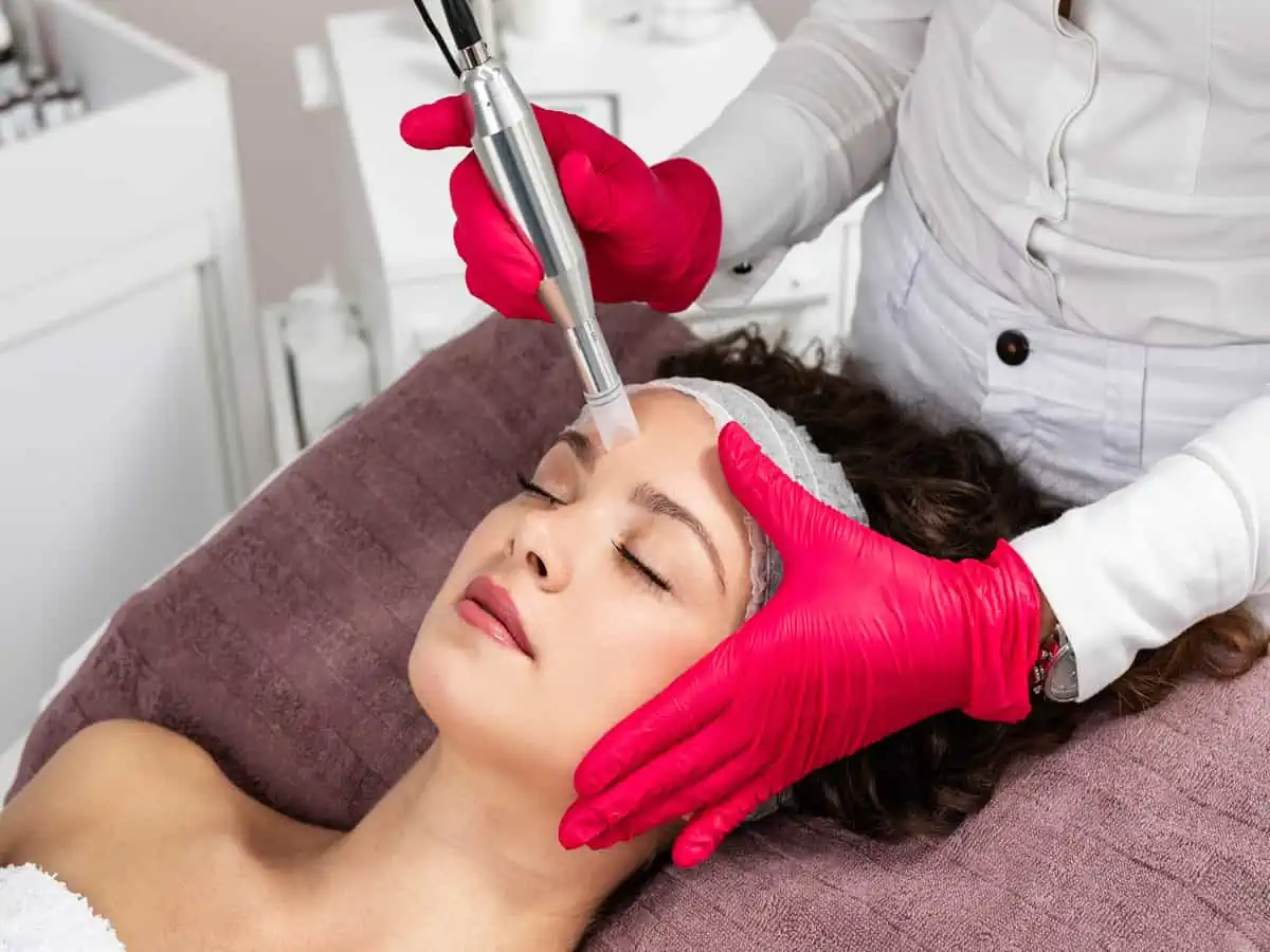 microneedling by dermablissspa in chicago,il