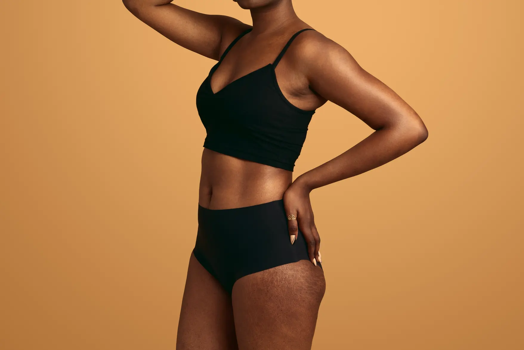Why Do Stretch Marks Form, and Why Are They So Difficult to Remove | Derma Bliss Medical Spa in Houston, TX